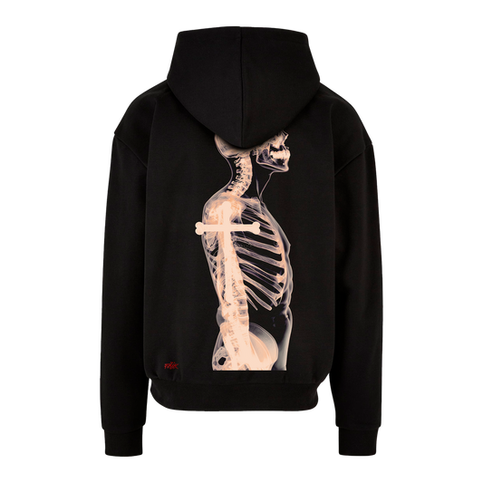 X Ray - Hoodie